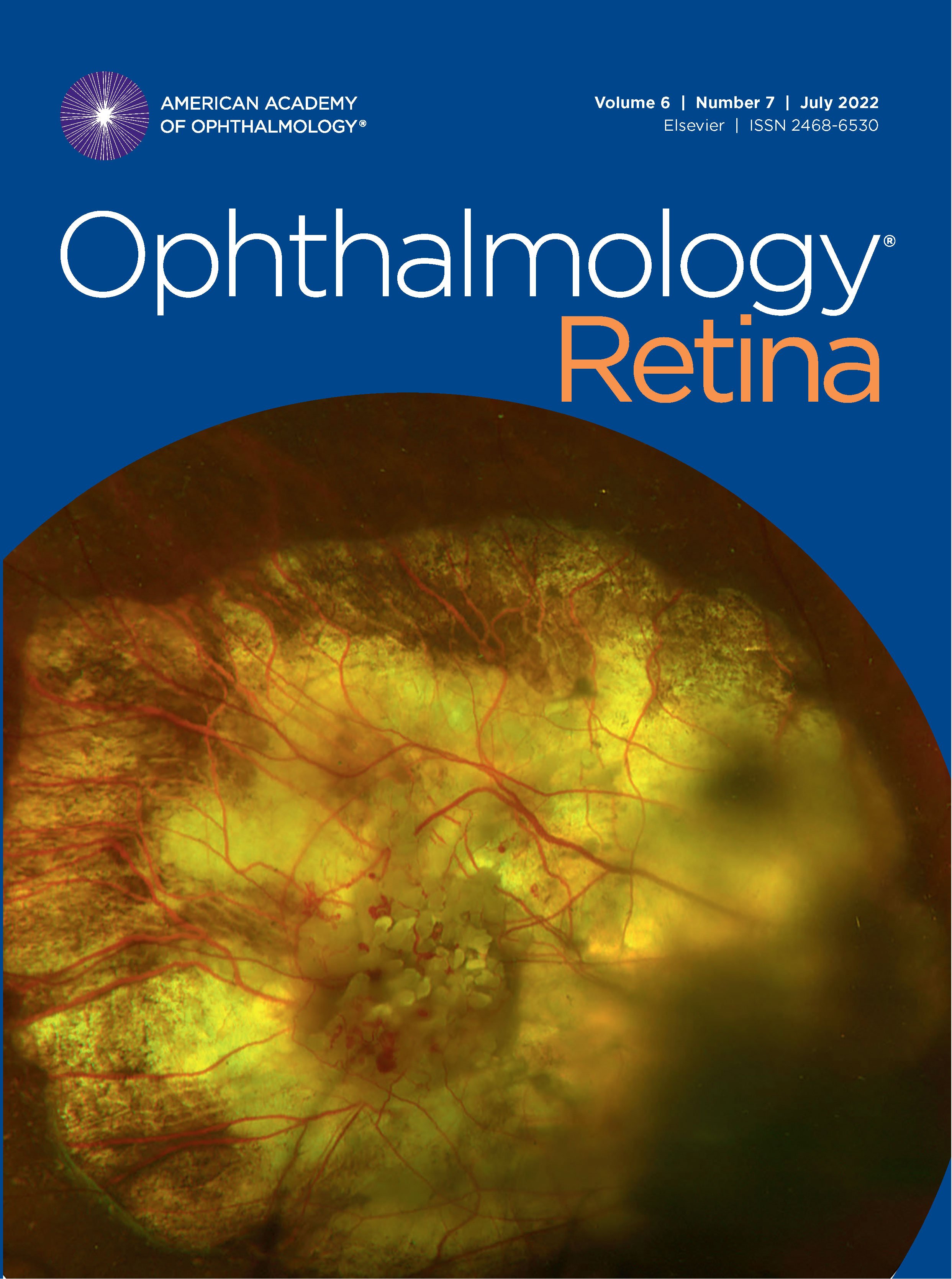 Ophthalmology Retina July 2022, Volume 6, Number 7 image