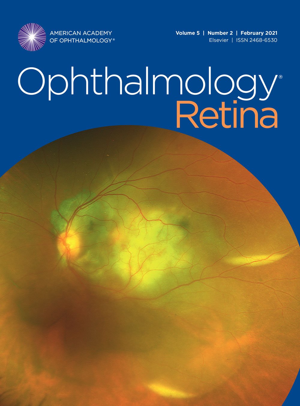Ophthalmology Retina February 2021, Volume 5 Issue 2 image