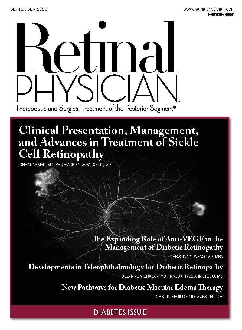 Retinal Physician September 2020 image
