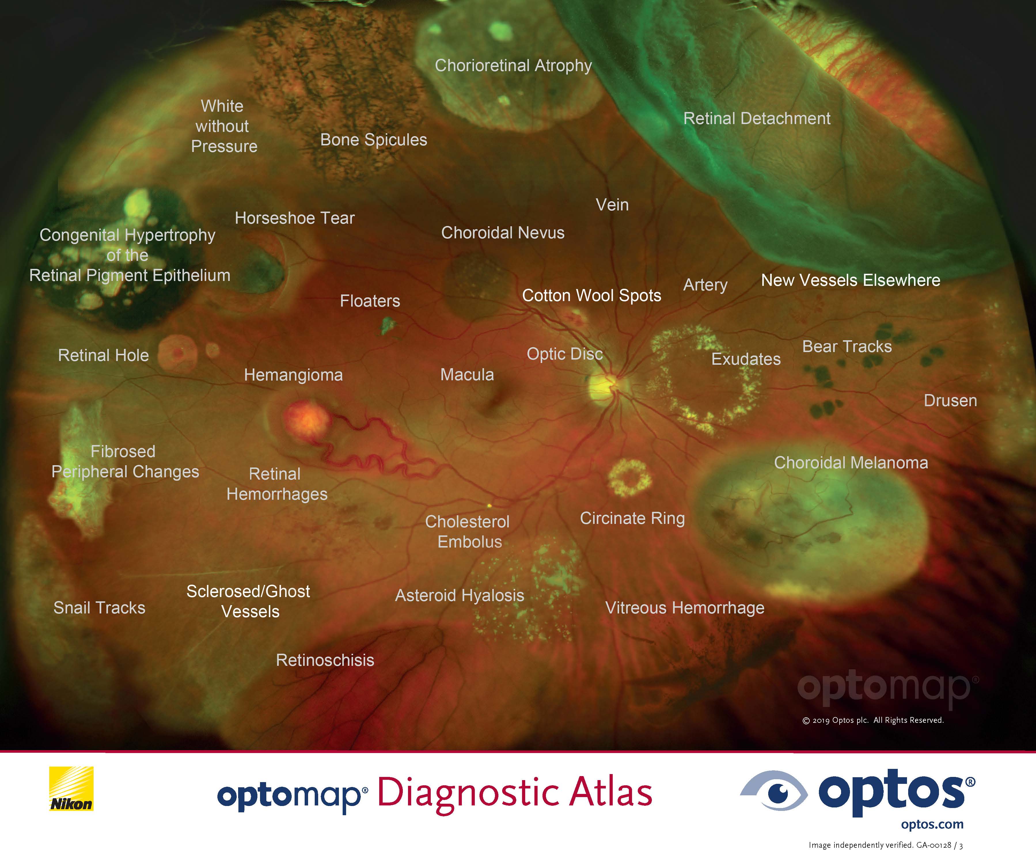 optomap color rg Diagnostic Atlas