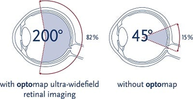 45 degree versus 200 degree retinal image