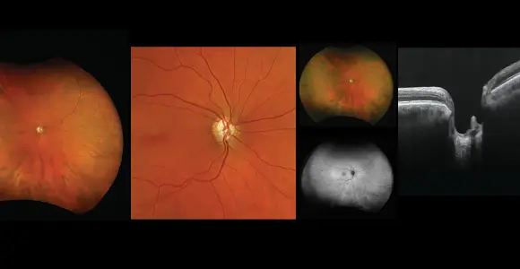 clical paper thumbnail image