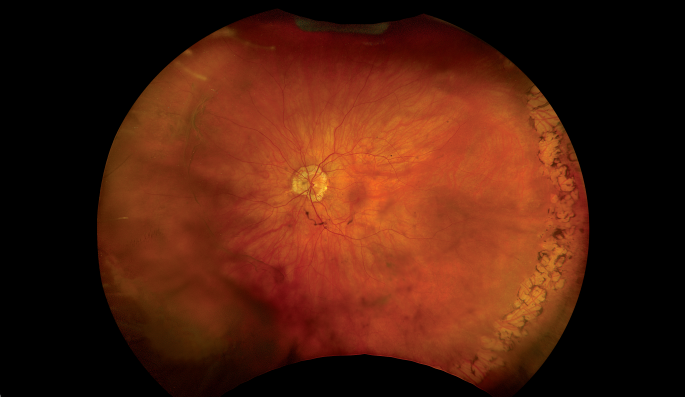 clical paper thumbnail image