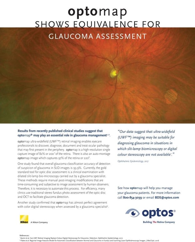 optomap shows equivalence for glaucoma awareness