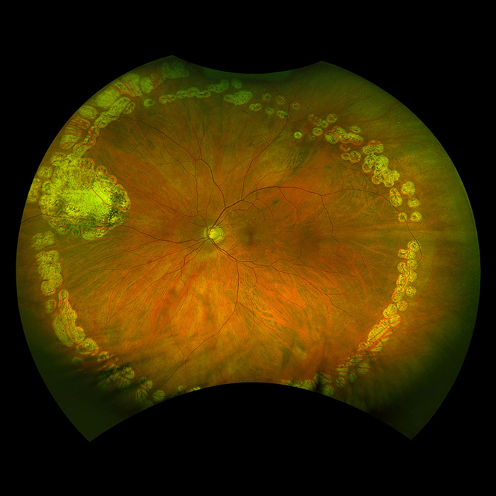 True Color Optos Optos Retinal Imaging Devices and Software Solutions | Learn More