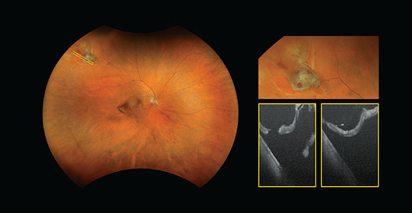 clical paper thumbnail image