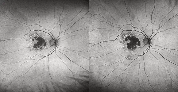 clical paper thumbnail image