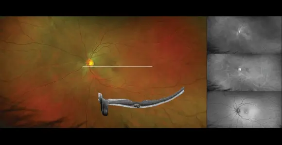 clical paper thumbnail image