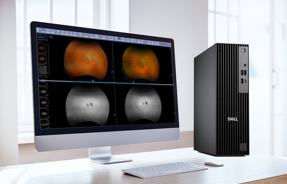 OptosAdvance with optomap images with PHI removed