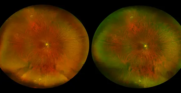 clical paper thumbnail image