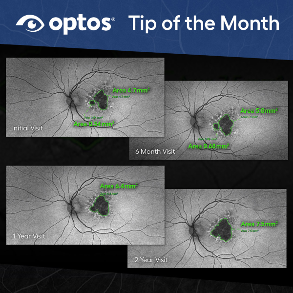 Area Assist Tip of the Month Image