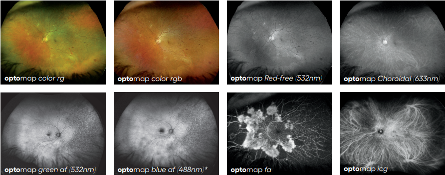 Clinical Papers and Research Using Optos Ultra-widefield Devices