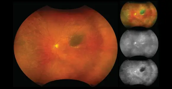 clical paper thumbnail image