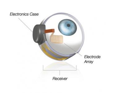 first retinal implant device
