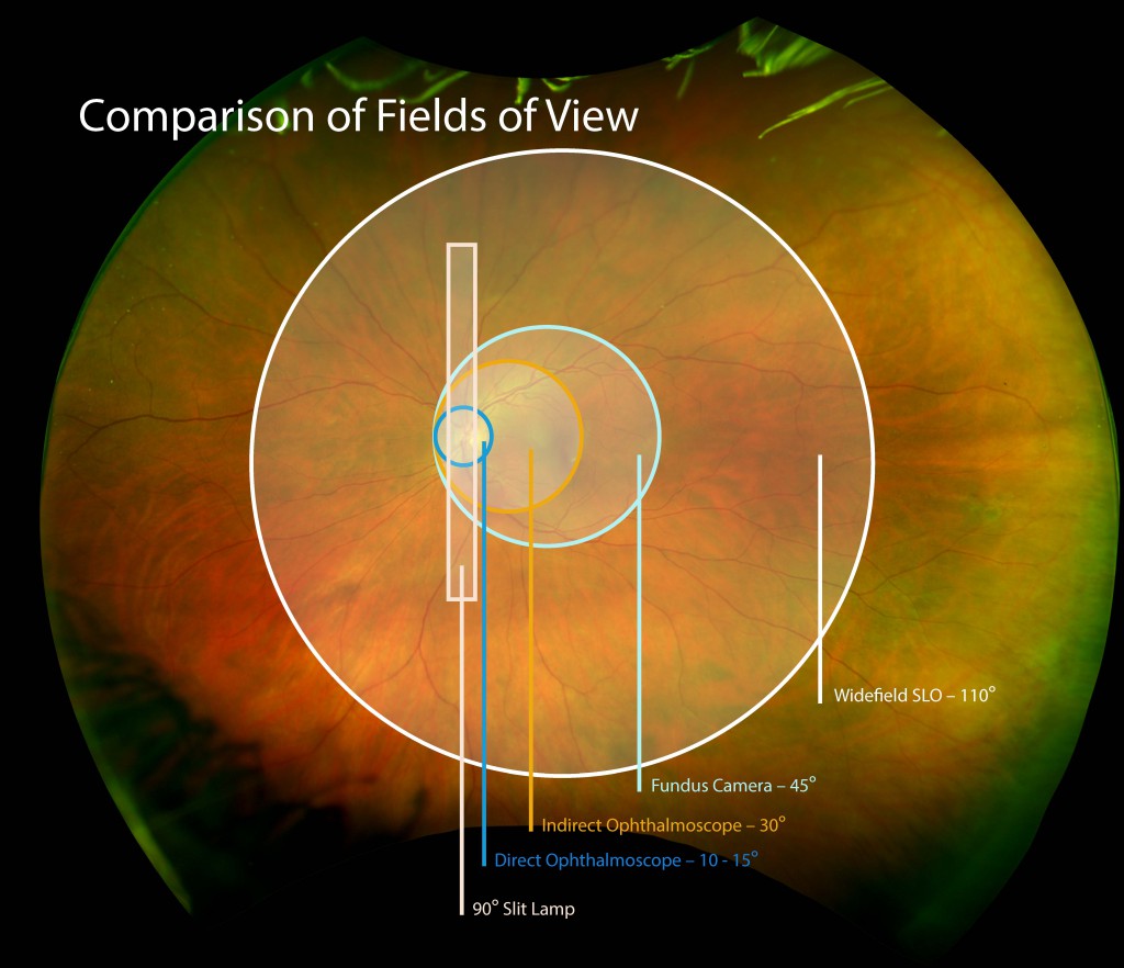 Comparison of Fields of View