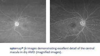 optomap UWF retinal images
