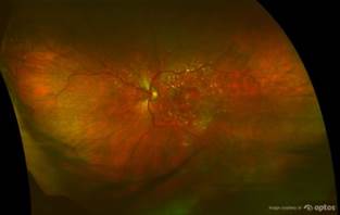 retinal scan 