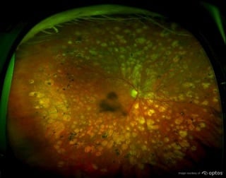retina scan 