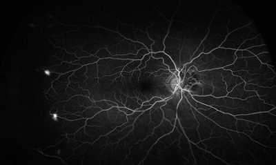 retinal scan 