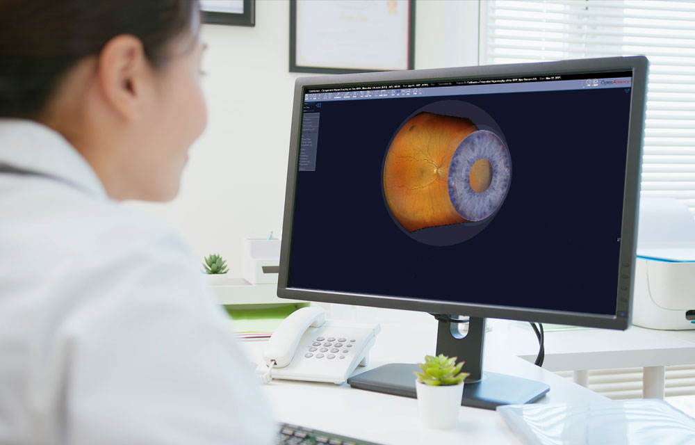 OptosAdvance Image Review