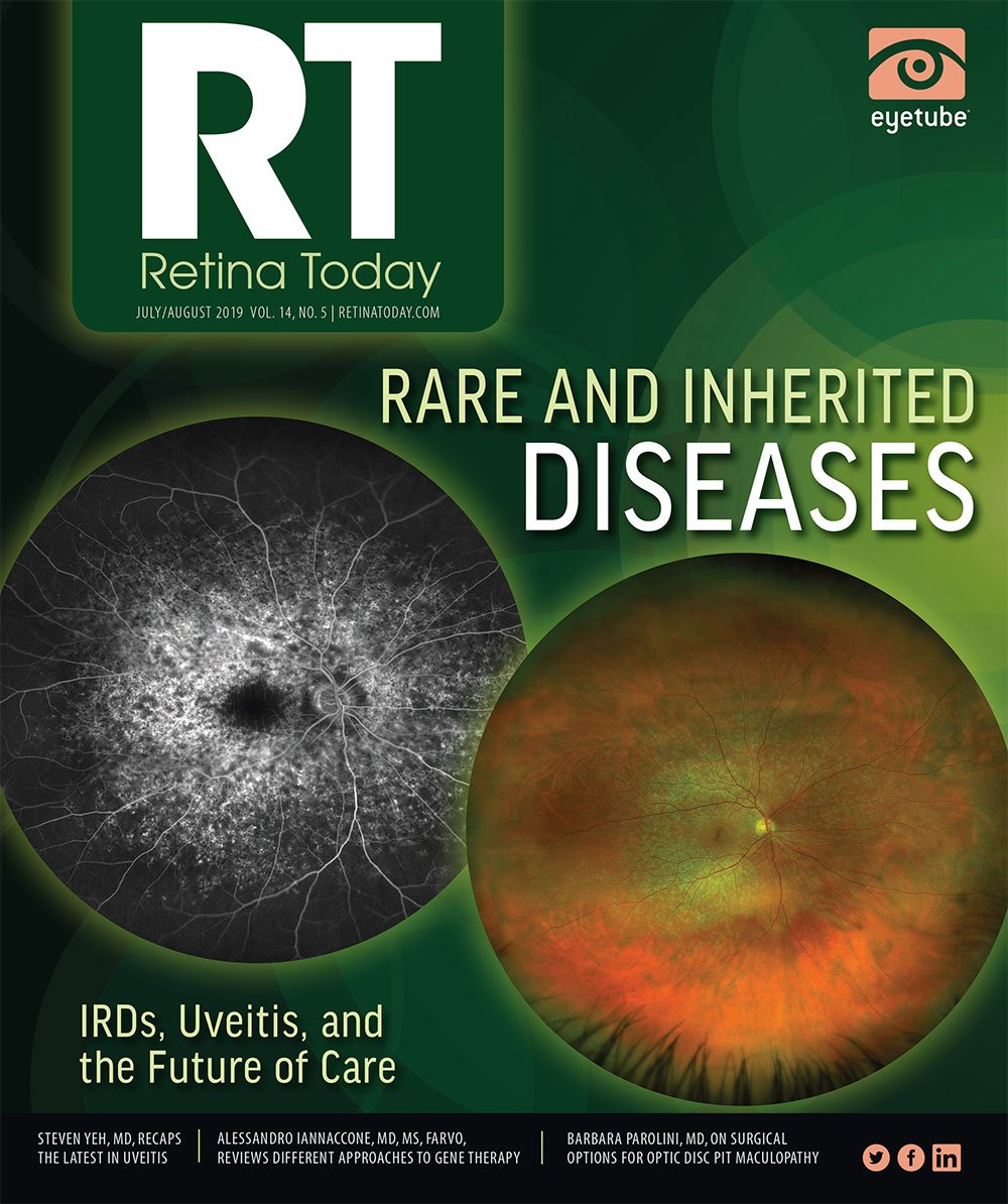Retina Today July/August 2019 image