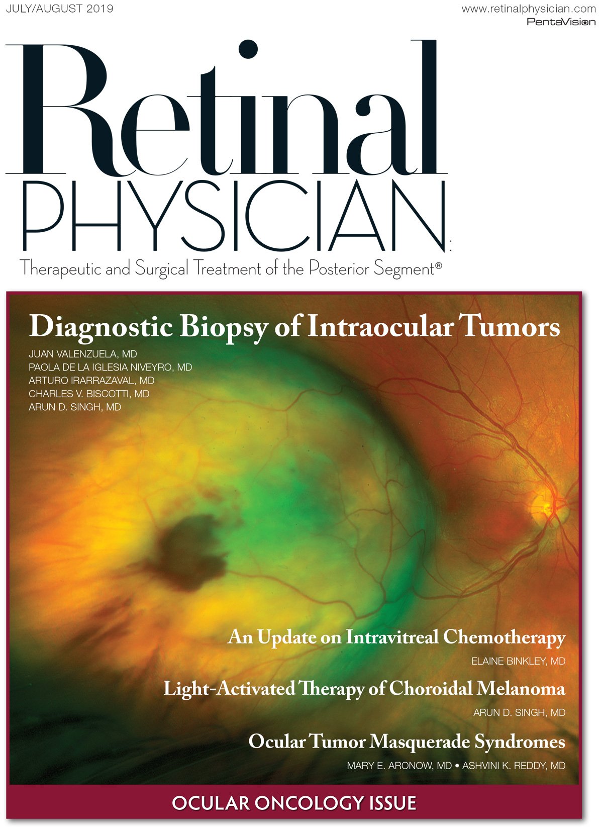 Retinal Physician July/August 2019 image