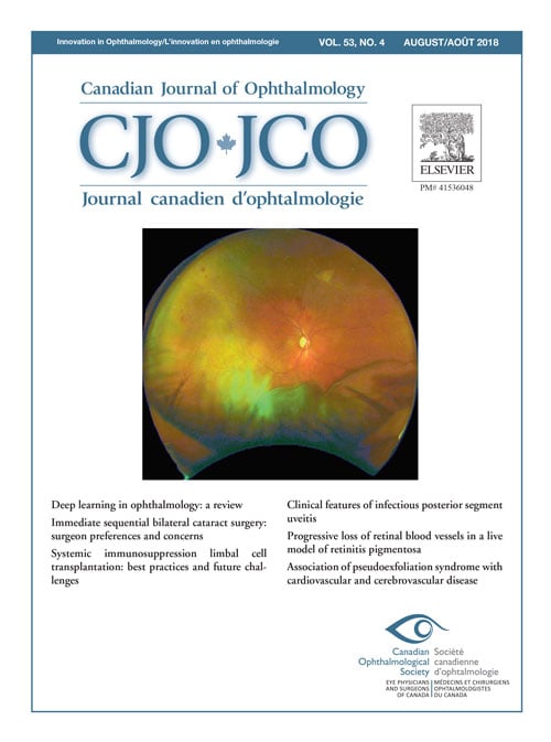 Canadian Journal of Ophthalmology August 2018 image