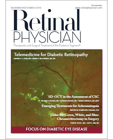 Retinal Physician November/December 2016 image