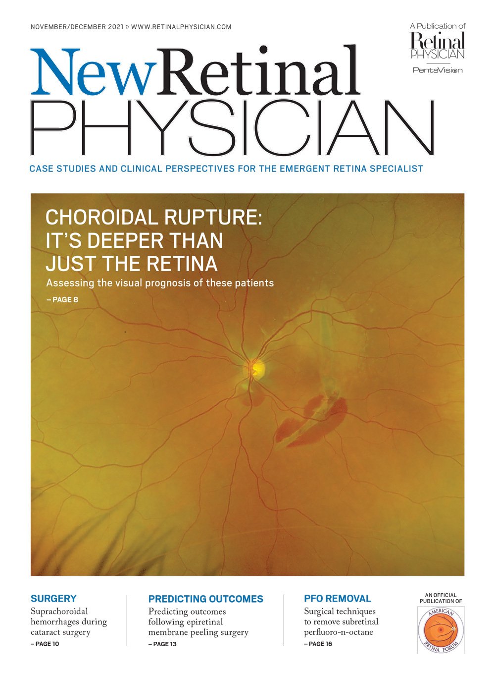 New Retinal Physician November/December 2021 image