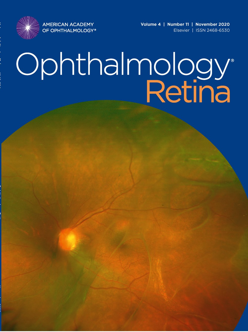 Ophthalmology Retina November 2020, Volume 4, Issue 11 image