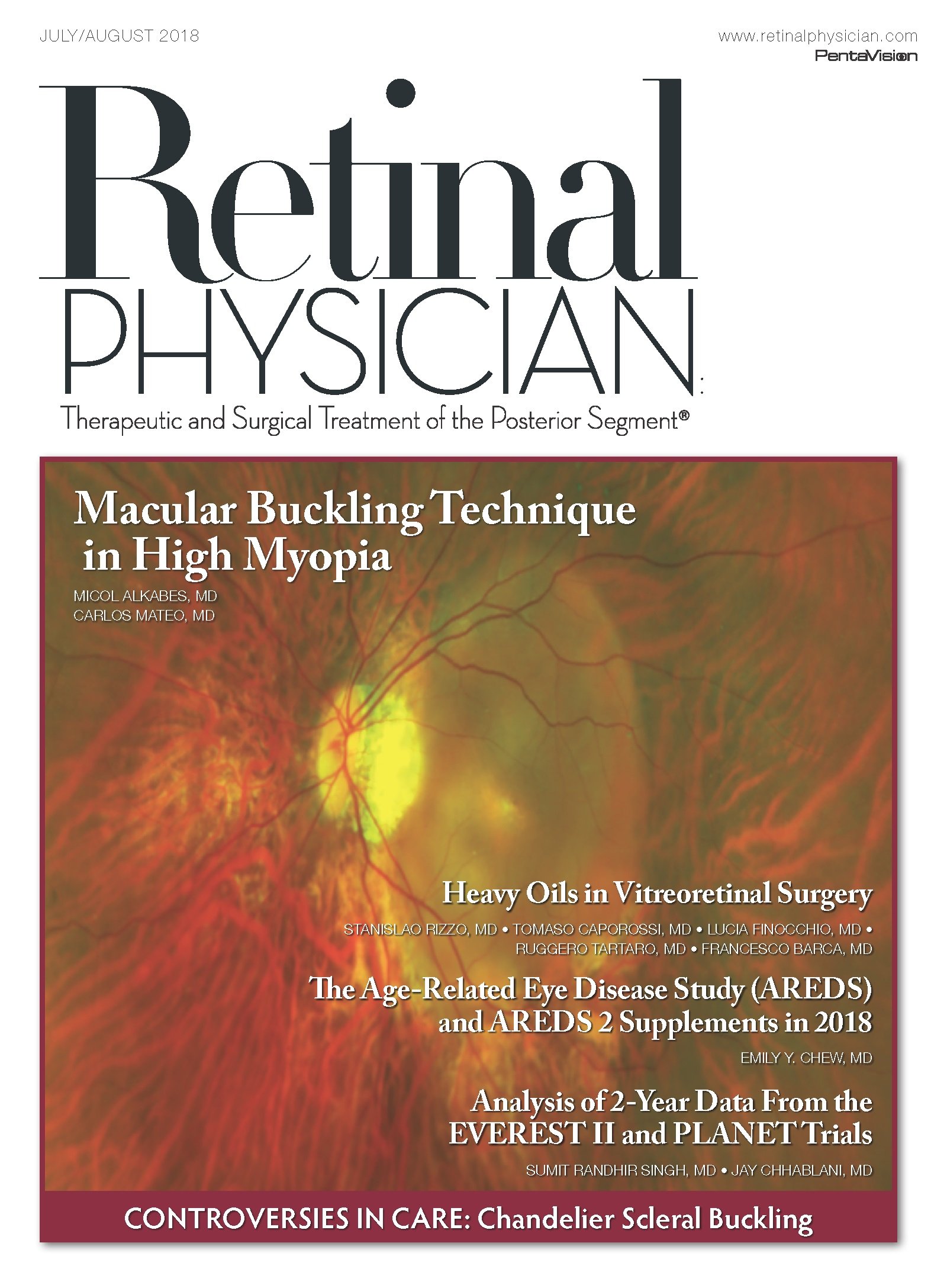 Retinal Physician July/August 2018 image