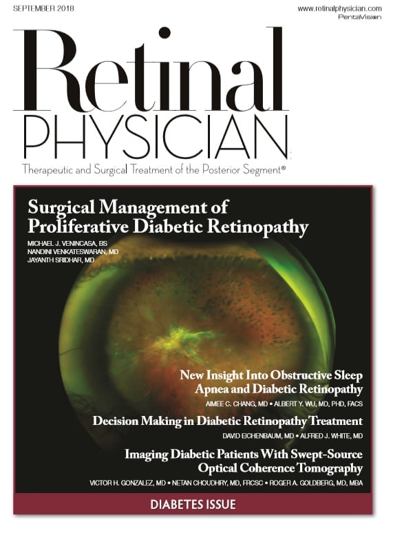 Retinal Physician September 2018 image