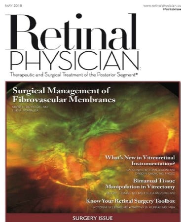 Retinal Physician  May 2018 image