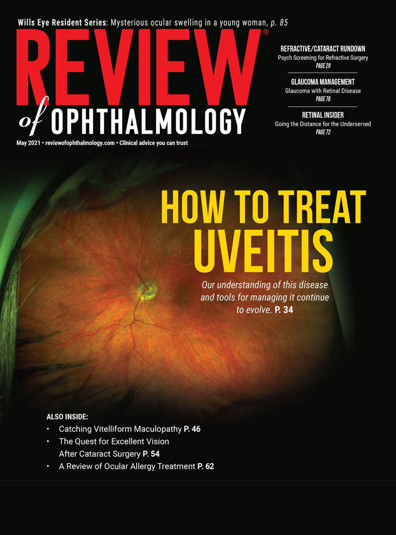 Review of Ophthalmology May 2021 image