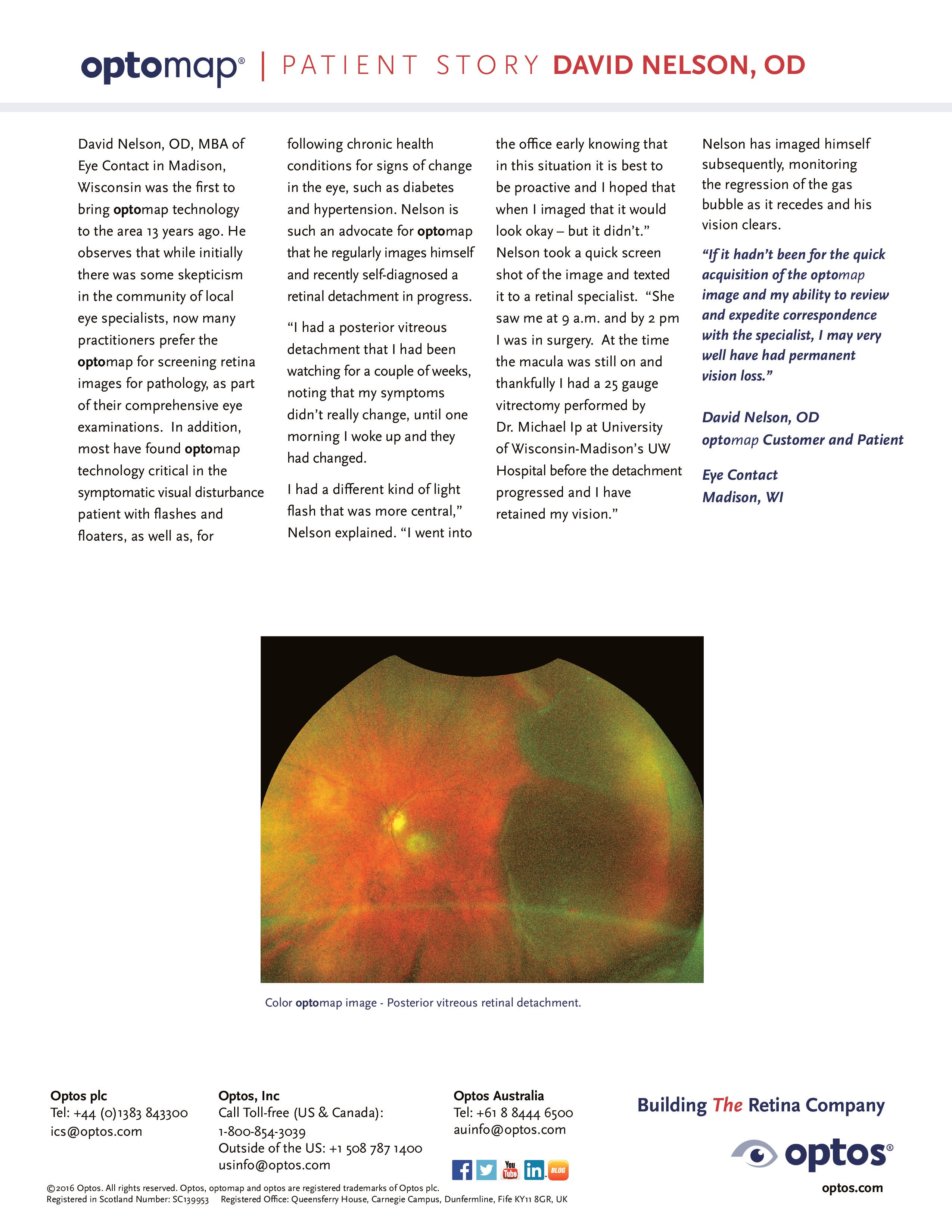 Detached Retina, Optometrist in Chicago, Illinois