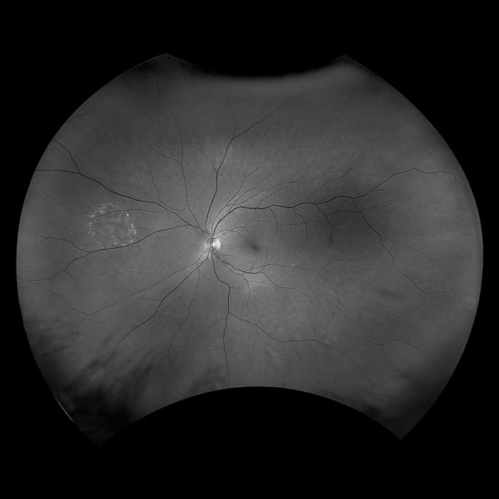 Optos Retinal Imaging Devices and Software Solutions | Learn More