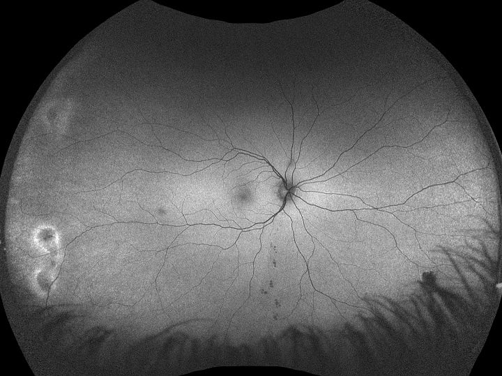 Optos Retinal Imaging Devices and Software Solutions | Learn More