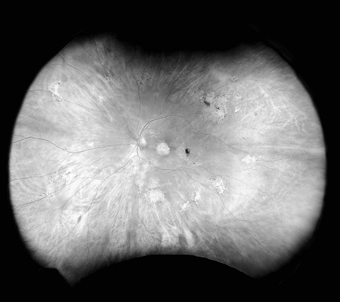 Optos Retinal Imaging Devices and Software Solutions | Learn More