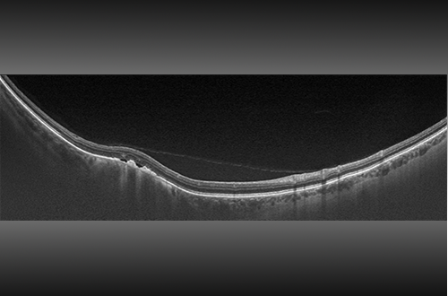 Optos Retinal Imaging Devices and Software Solutions | Learn More