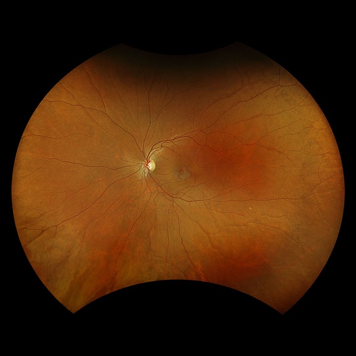 OCTアトラス Frontiers | Bioinformatics-based construction of prognosis