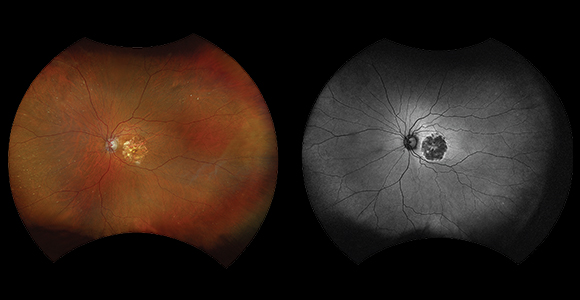 Clinical paper thumbnail image