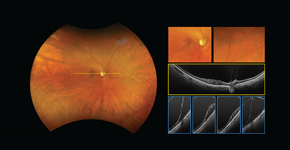 clical paper thumbnail image