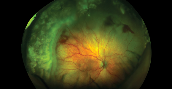 Clinical paper thumbnail image