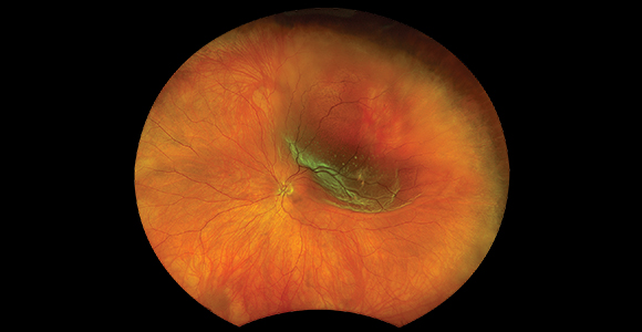 clical paper thumbnail image