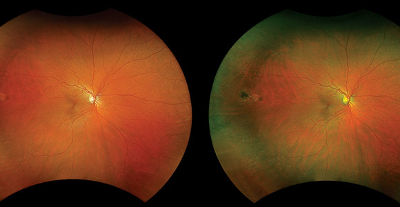 clical paper thumbnail image