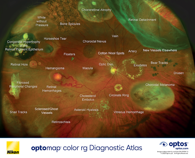 optomap color rg Diagnostic Atlas