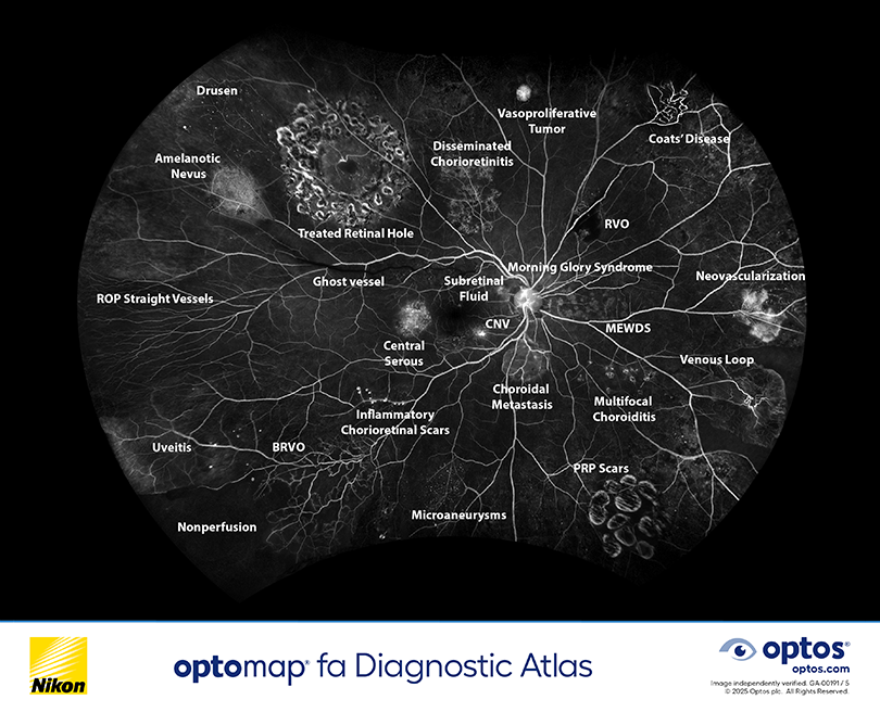 Diagnostic Atlas - optomap&nbsp;fa