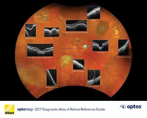 Diagnostic Atlas Booklet &ndash; optomap OCT