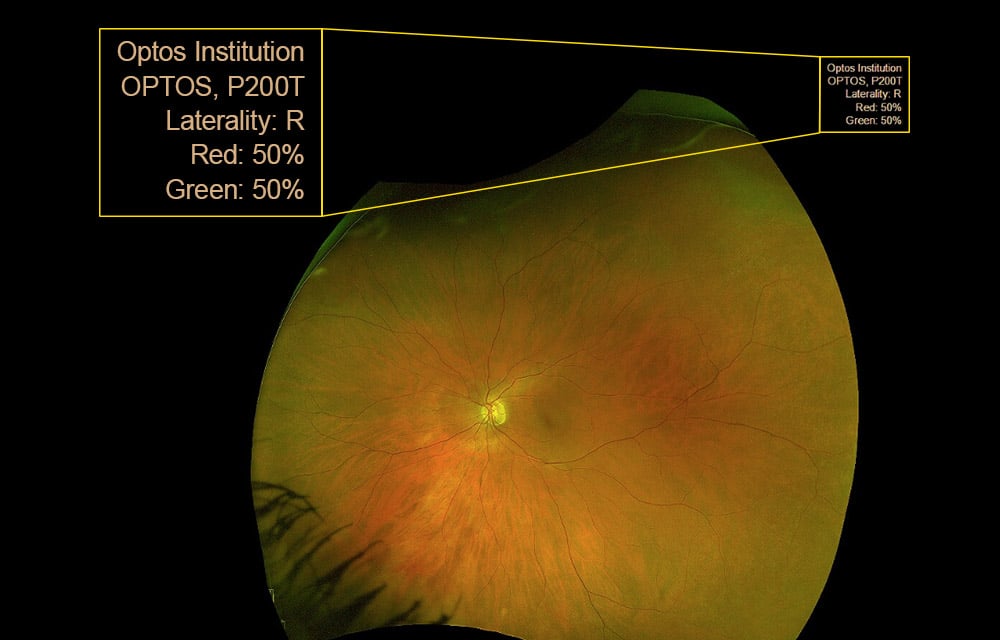 Tip of the month Aug 2026 