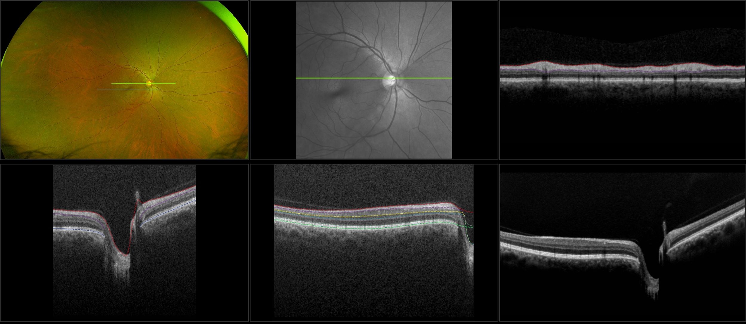 Monaco RG, Stereo, OCT